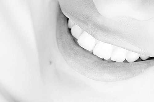 soins dentaires Soumoulou Le blanchiment dentaire